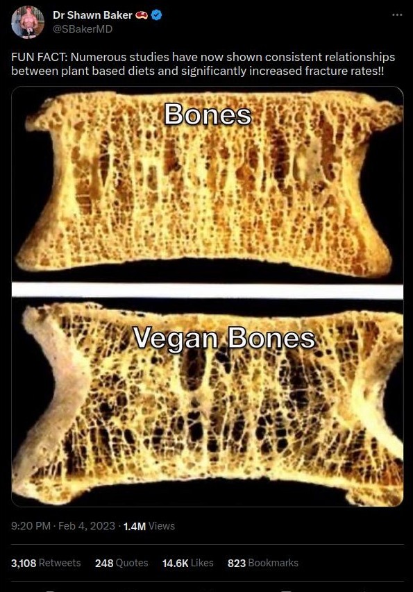 Tweet With 1.4M Views, 3108 Retweets, 248 Quotes,  14.6K Likes, 823 Bookmarks By Dr Shawn Baker, meat emoji. @SBakerMD.  Text reads: FUN FACT: Numerous studies have now shown consistent relationships between plant based diets and significantly increased fracture rates!! End of text. The image included in the tweet allegedly shows the cross-section of a normal bone labeled Bones and a porous bone labeled Vegan Bones.   9:20 PM · Feb 4, 2023 